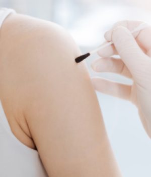 Allergy test. Young confident optimistic patient sitting in the clinic and getting treatment while pediatrician applying the cotton swab with iodine on the skin of the teenager